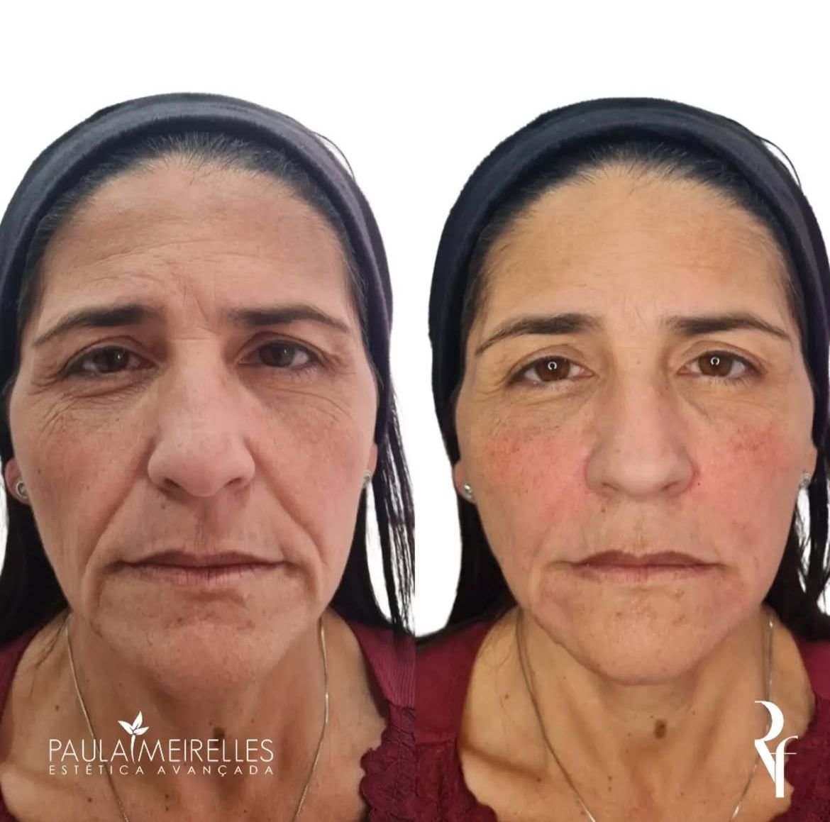 WhatsApp Image 2025-12-03 at 9.09.45 AM