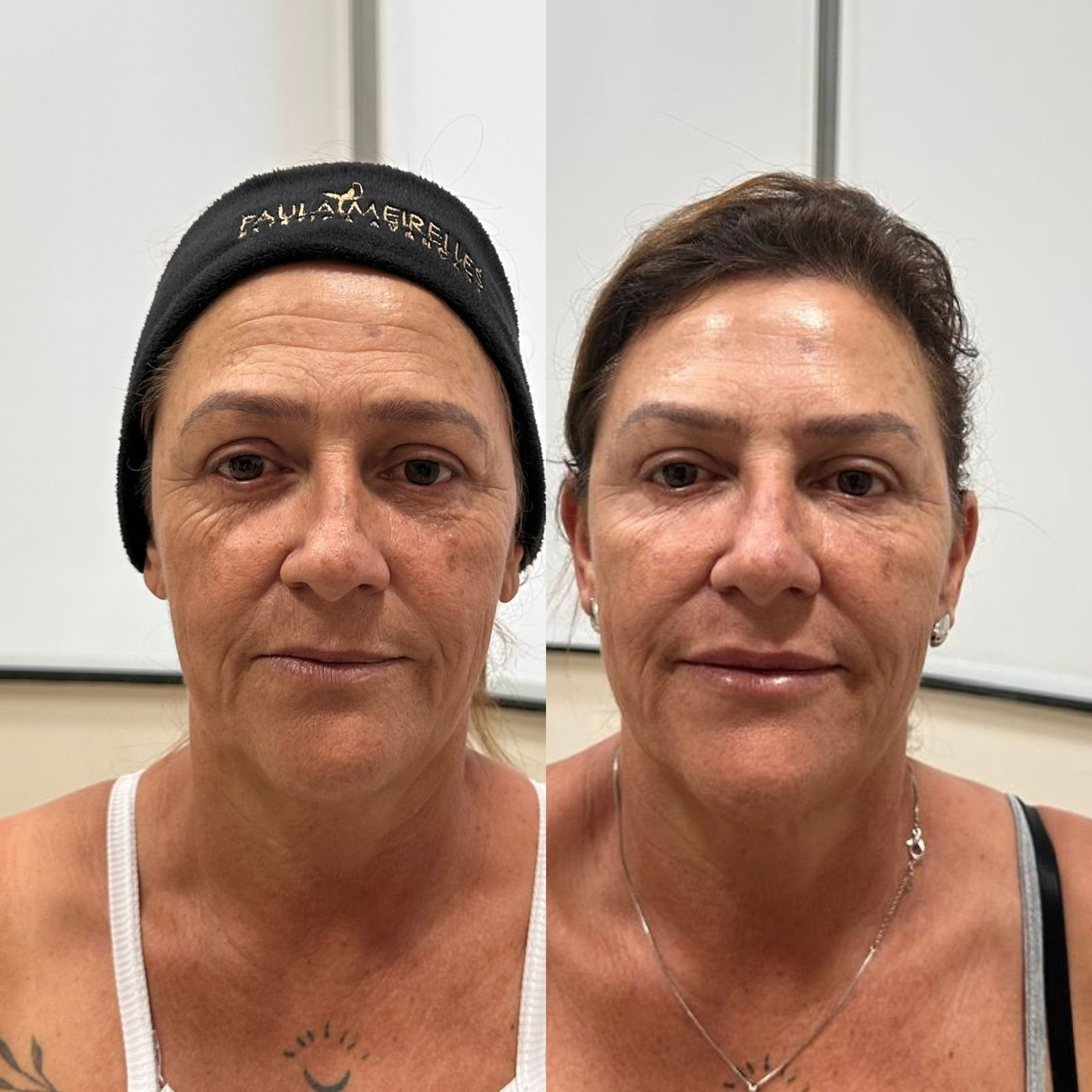 WhatsApp Image 2025-12-03 at 9.13.16 AM